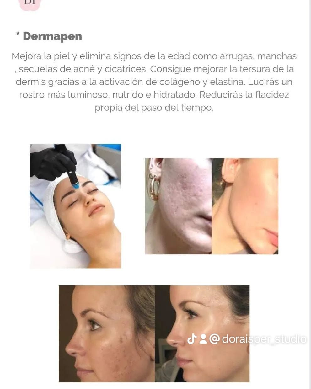 DORA ISPER STUDIO - DERMAPEN