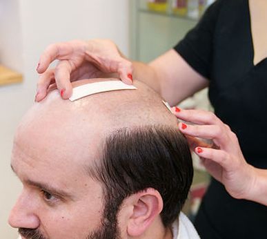 Regrow Your Hair. Permanently. Naturally. Regrow Your Hair. Permanently. Naturally.