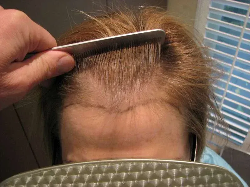 A woman is getting her eyebrows done at a beauty salon.