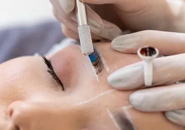 EYEBROW TRANSPLANT