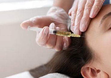 PRP THERAPY