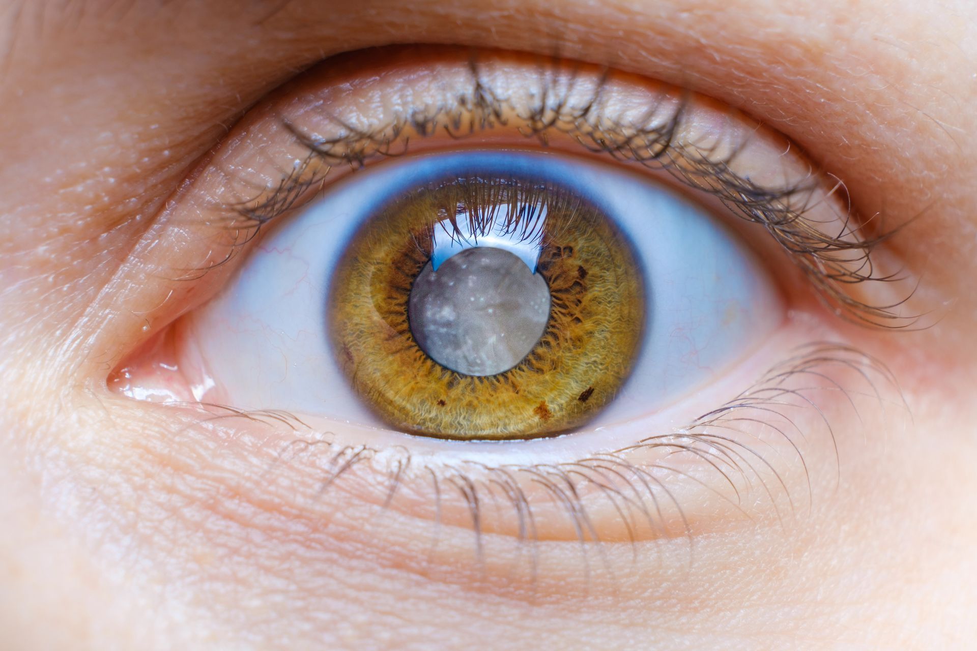 A computer screen shows a lens thickness