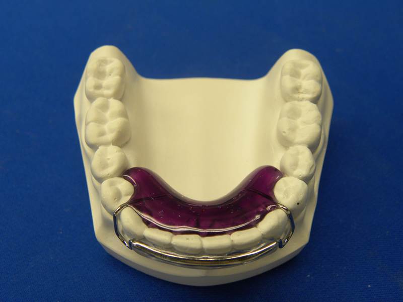 Orthodontic Appliances Sydney, NSW Macono Orthodontic & Dental