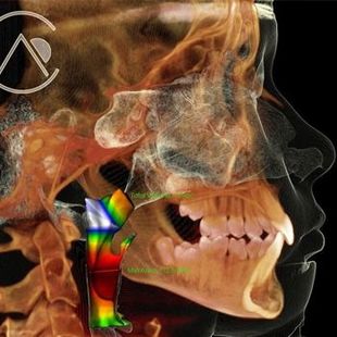 Side-view medical scan of a skull and jaw with colorful 3D spinal alignment overlay.
