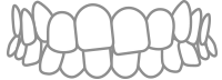 Outline of upper and lower teeth in a dental chart style diagram