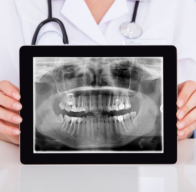 Doctor holding a tablet displaying a dental X-ray of teeth and jaw