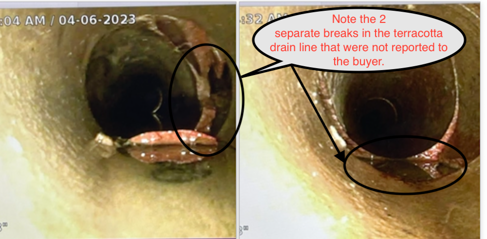 Side-by-side endoscopic ear canal images highlighting a yellowish lesion and a circled area of concern
