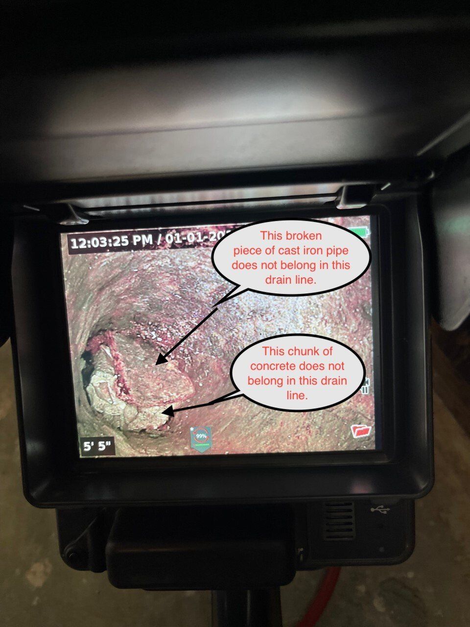 Monitor showing a medical scan with annotated speech bubbles on a dark background