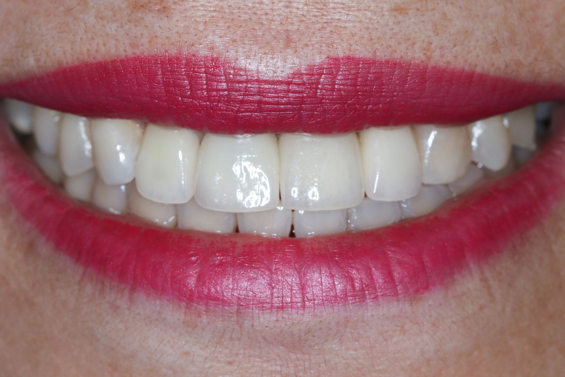 A close up of a person 's mouth with white teeth.