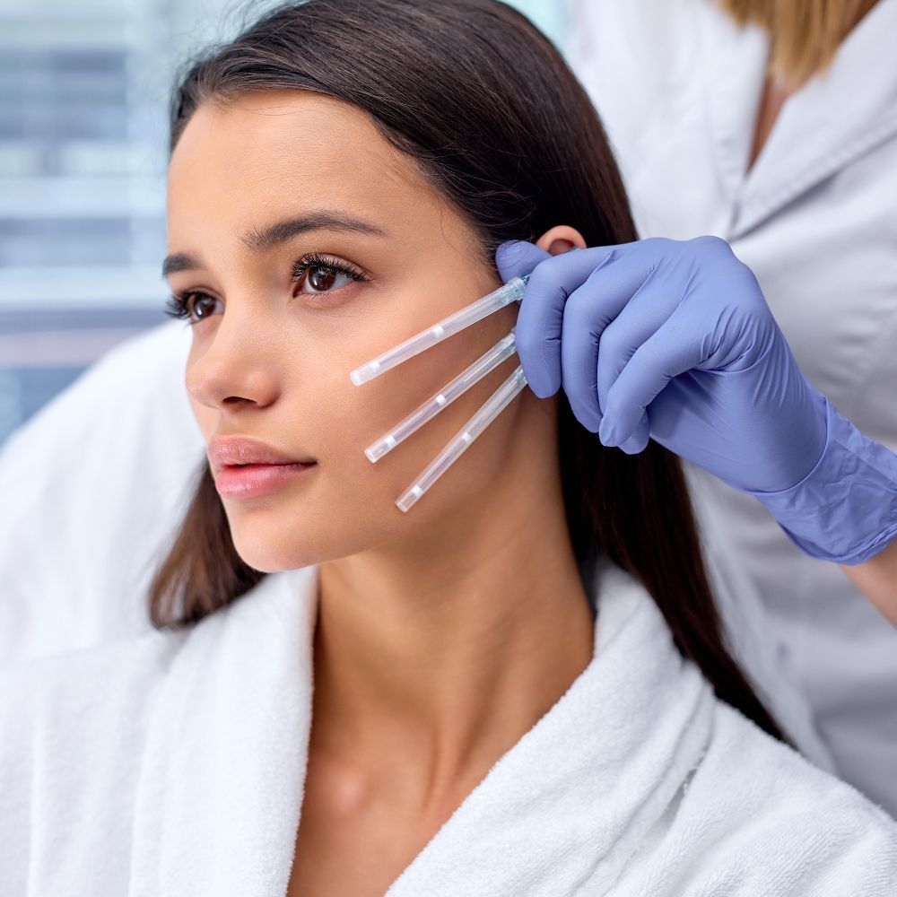 PDO threads held against the cheek before placement