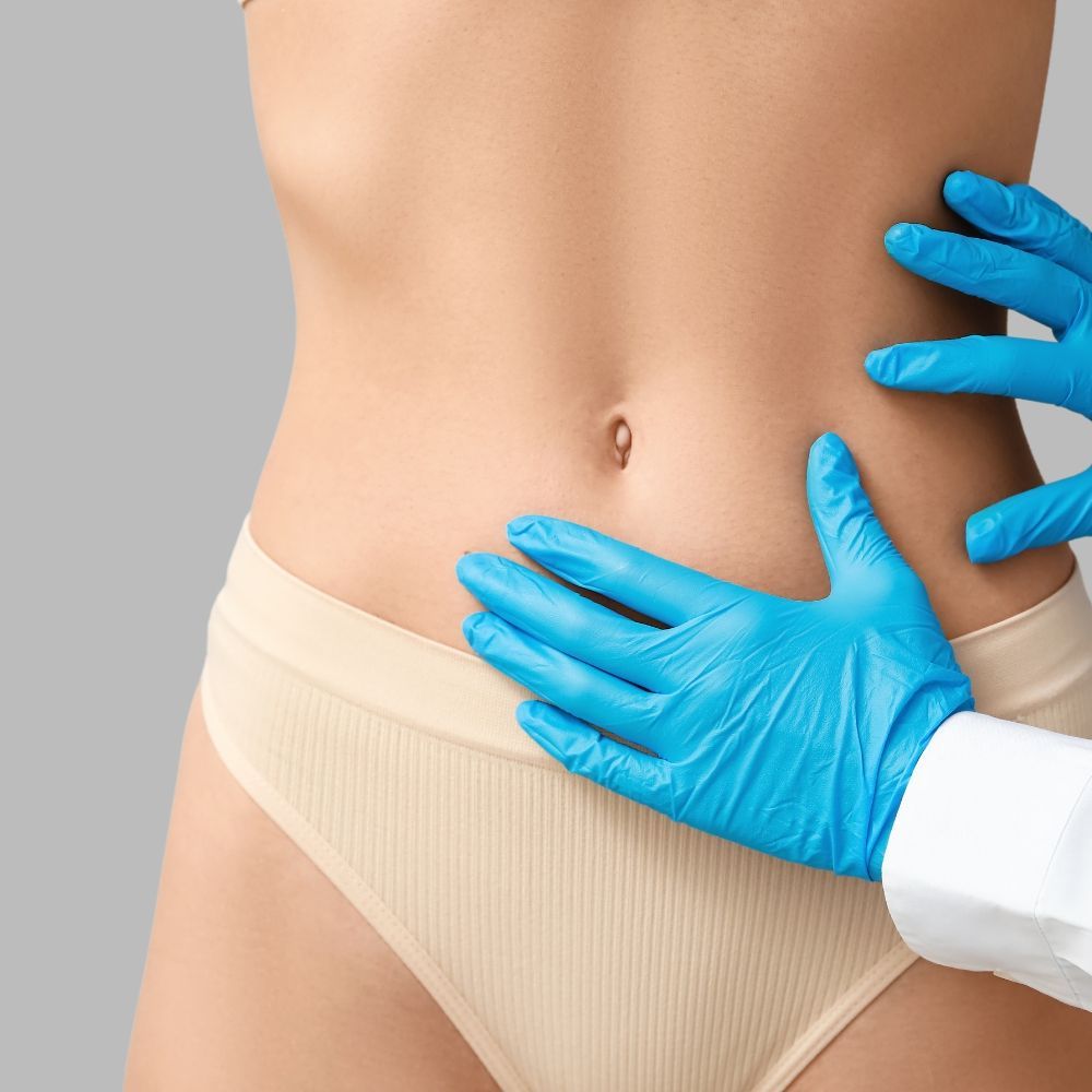 The abdomen being assessed and marked before awake liposuction