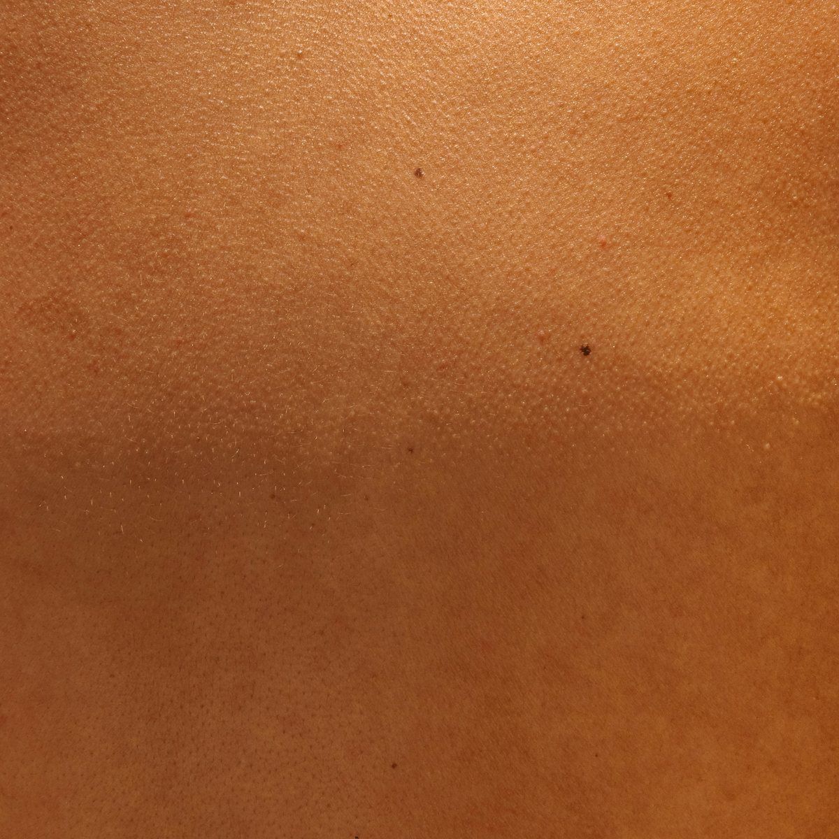 Healthy skin quality and even texture