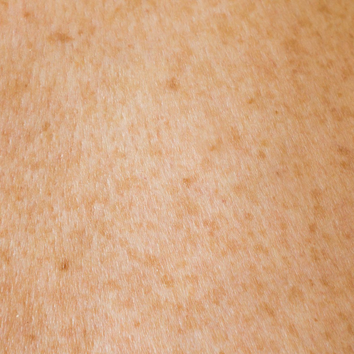 Refined skin texture and an even tone