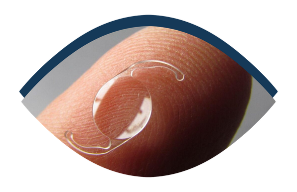 Lente intraocular utilizada na cirurgia de catarata.