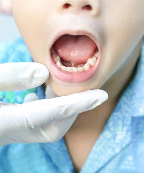 A close up of a child 's mouth with his tongue sticking out.