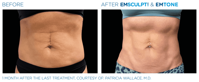 1 month after last treatment of stomach
