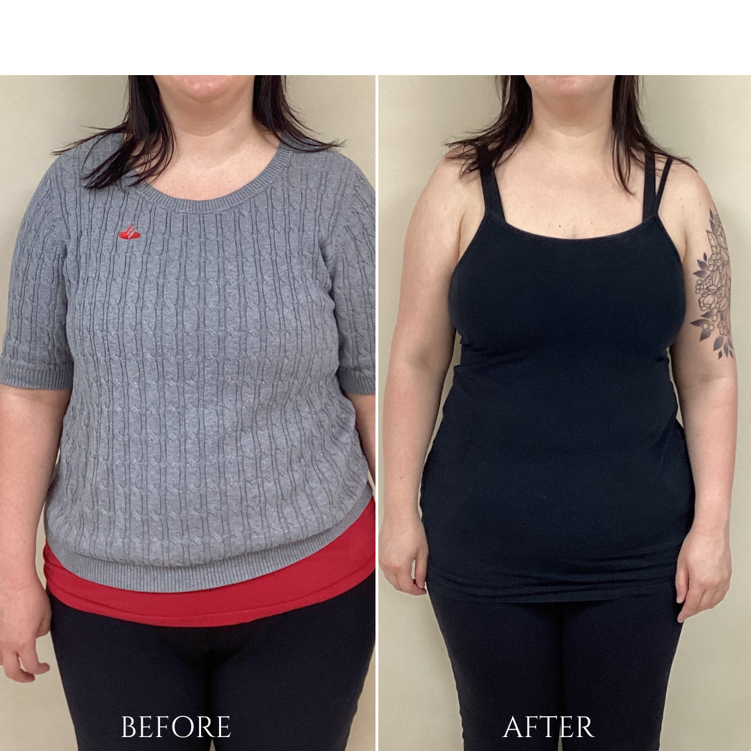 A side-by-side comparison of the same person before and after weight loss, wearing similar black pants in both photos.