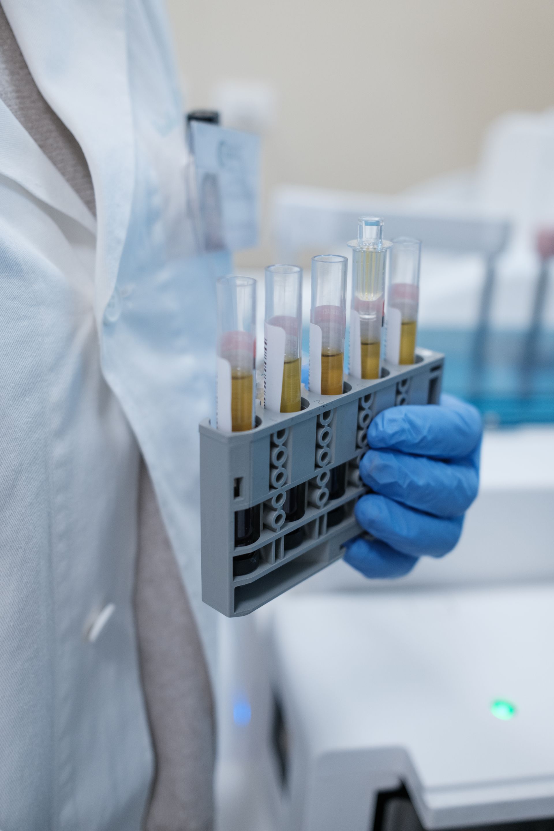 Uno scienziato tiene in mano un vassoio di provette in un laboratorio.