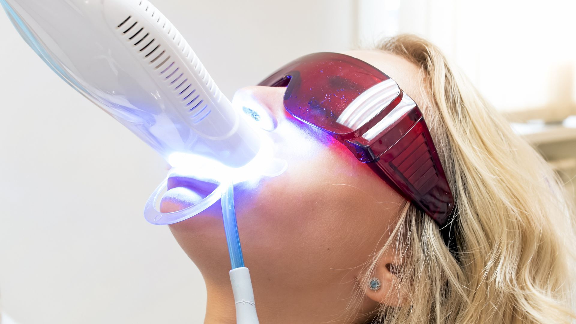 A woman is getting a teeth whitening procedure at a dental office.
