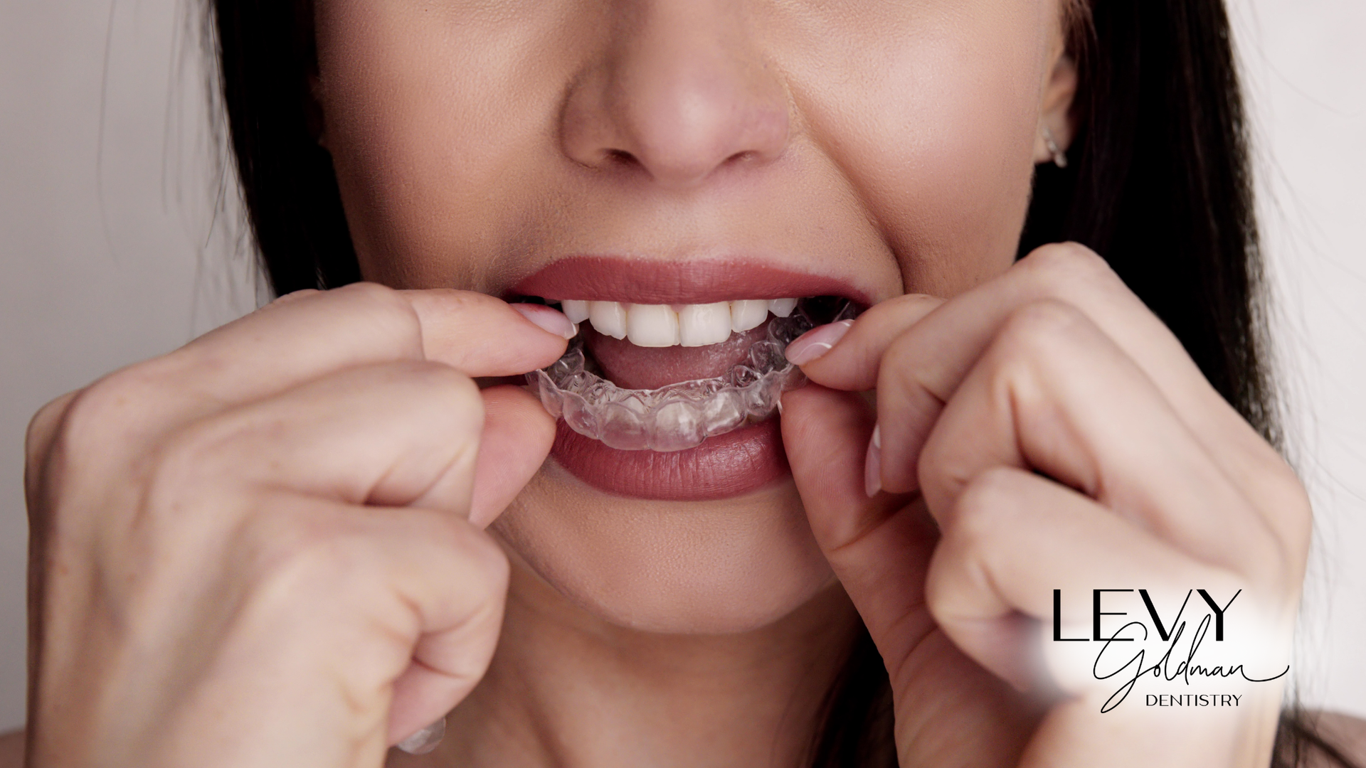 A woman is putting a clear brace on her teeth.
