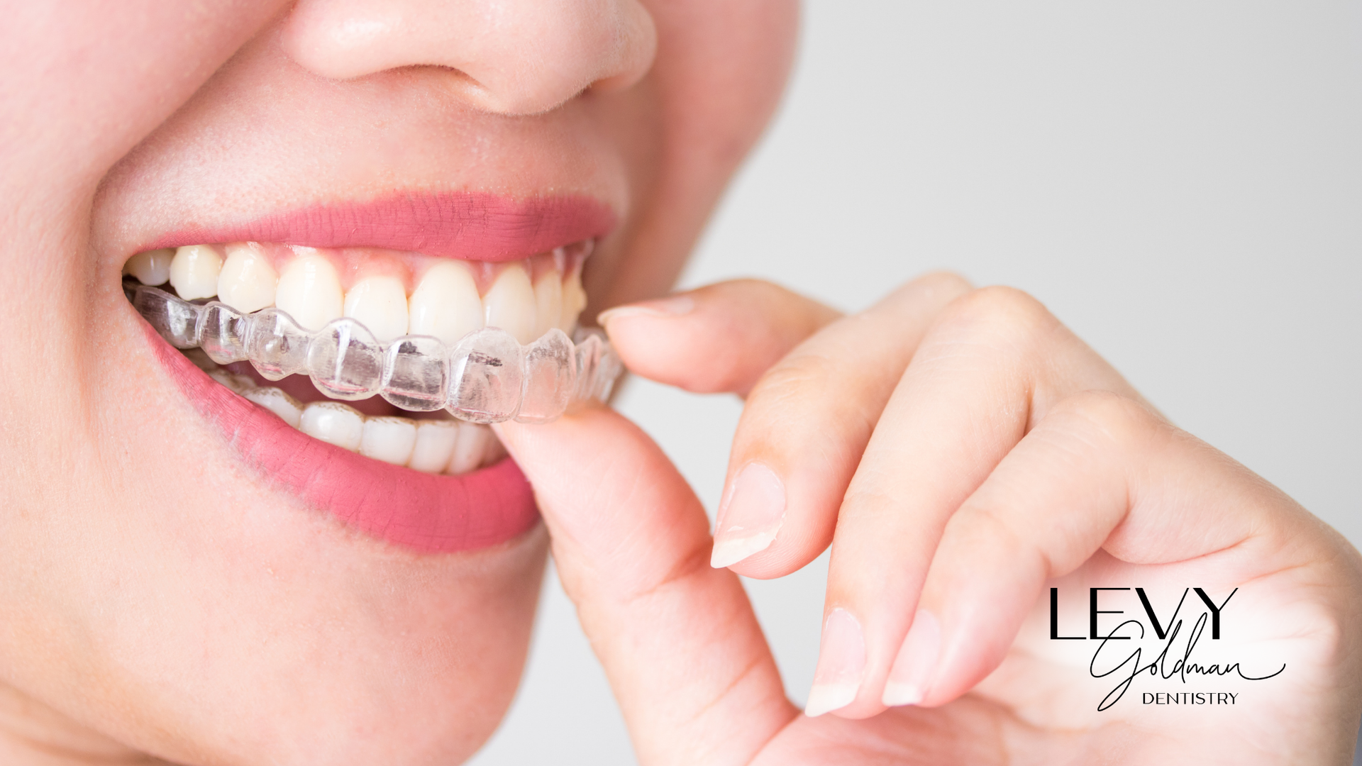 A woman is putting a clear brace on her teeth.