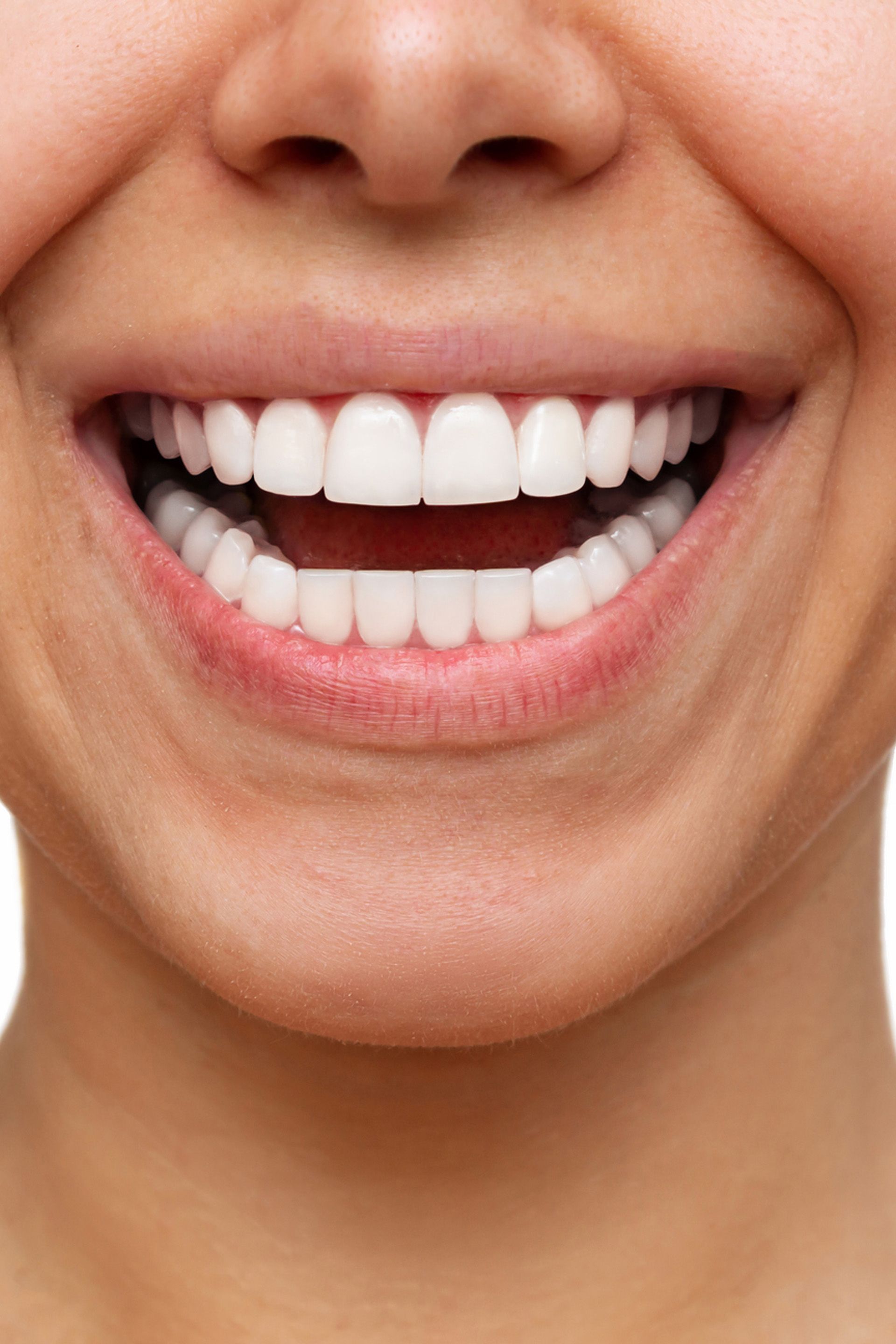 Smile Gallery