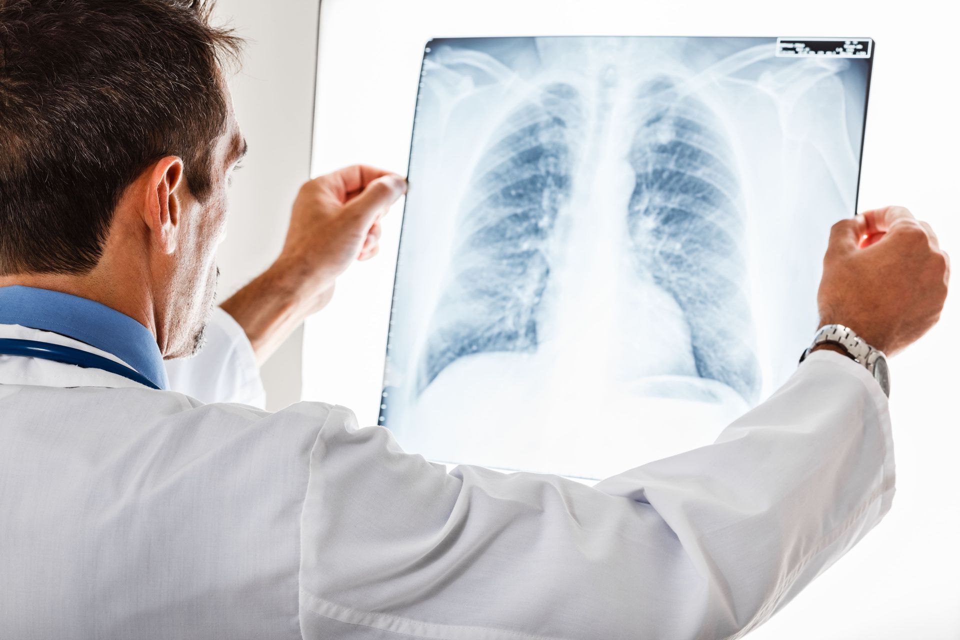 Médico analisando radiografia de tórax em consultório