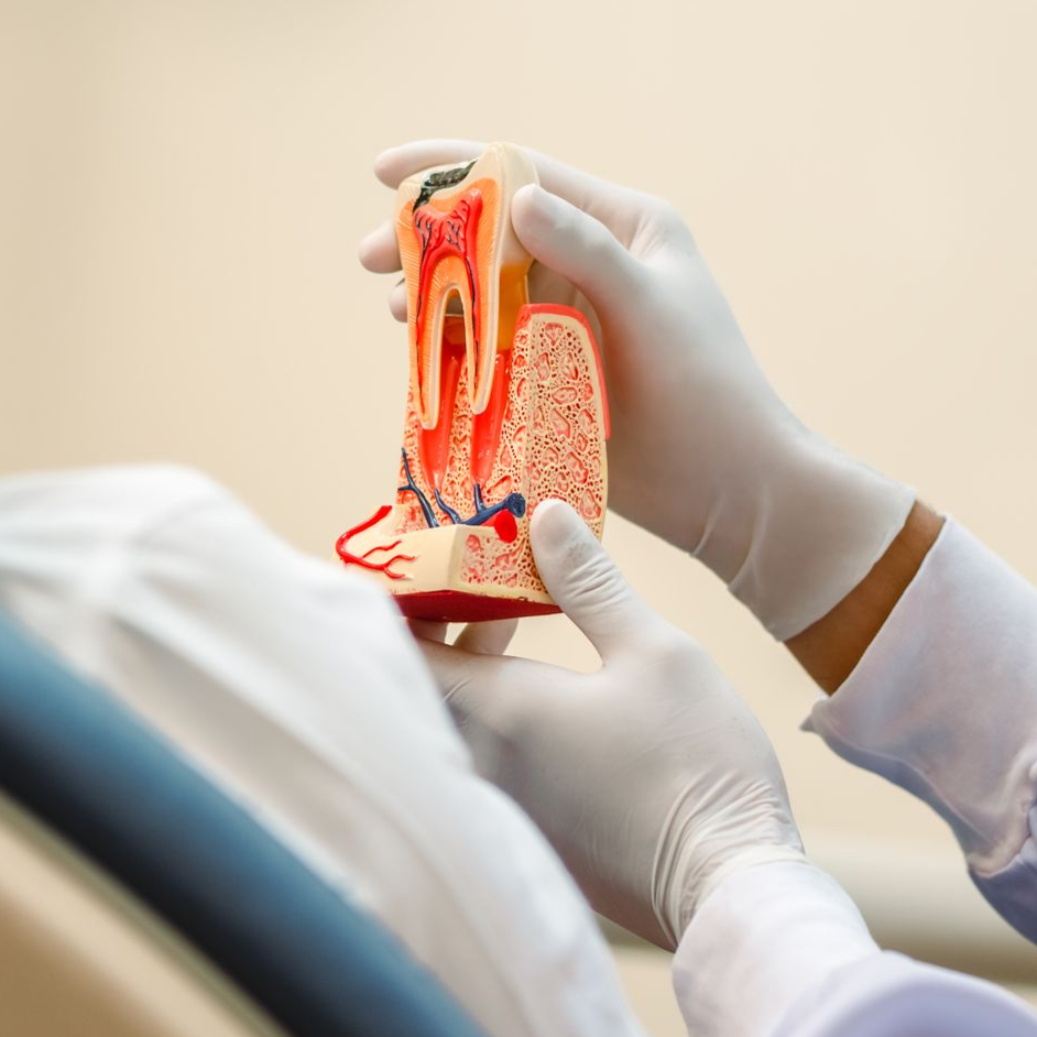 Gloved hands holding a cross-section dental model showing tooth roots and gums