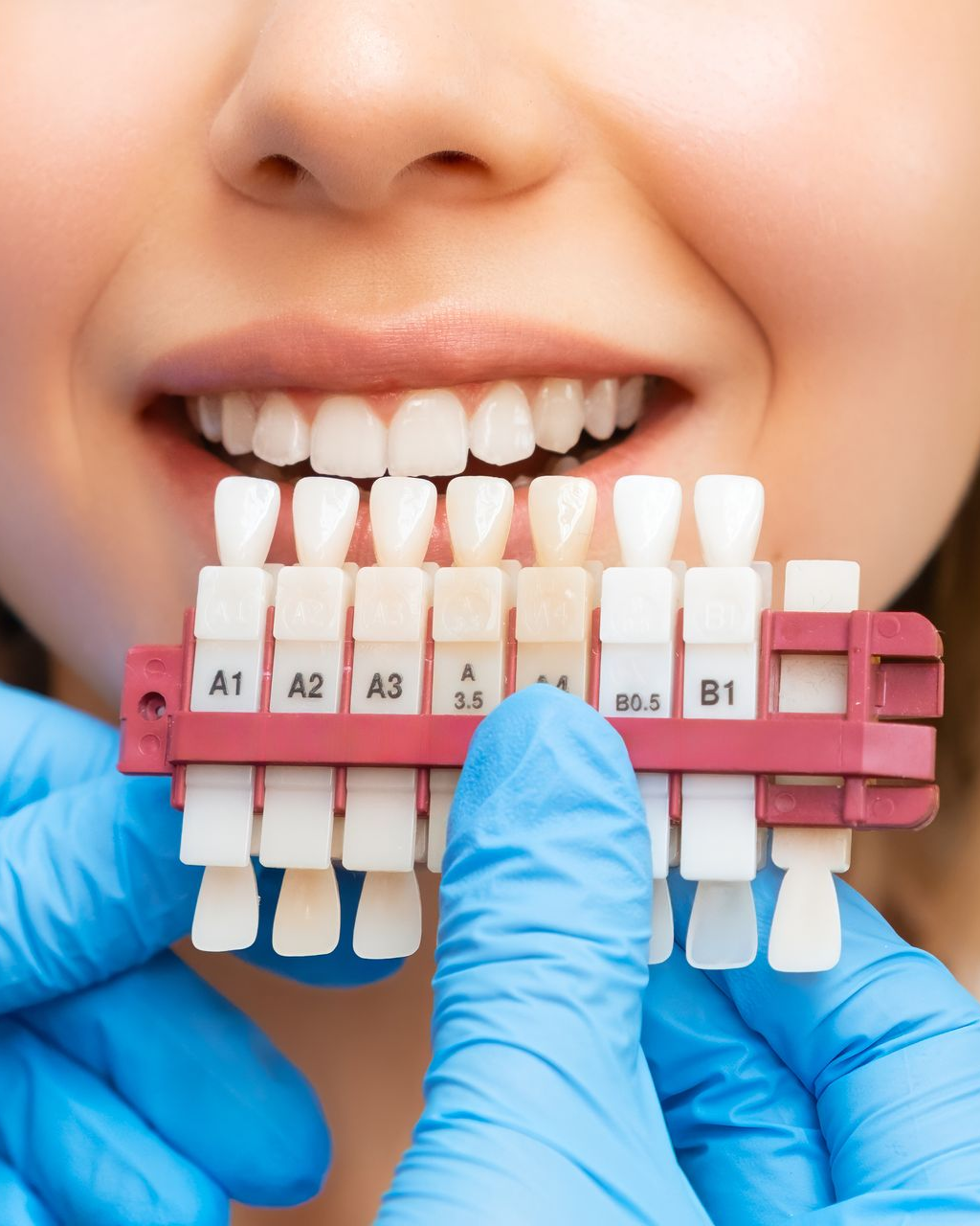 Dentist comparing tooth shades with a color guide in front of a smiling mouth