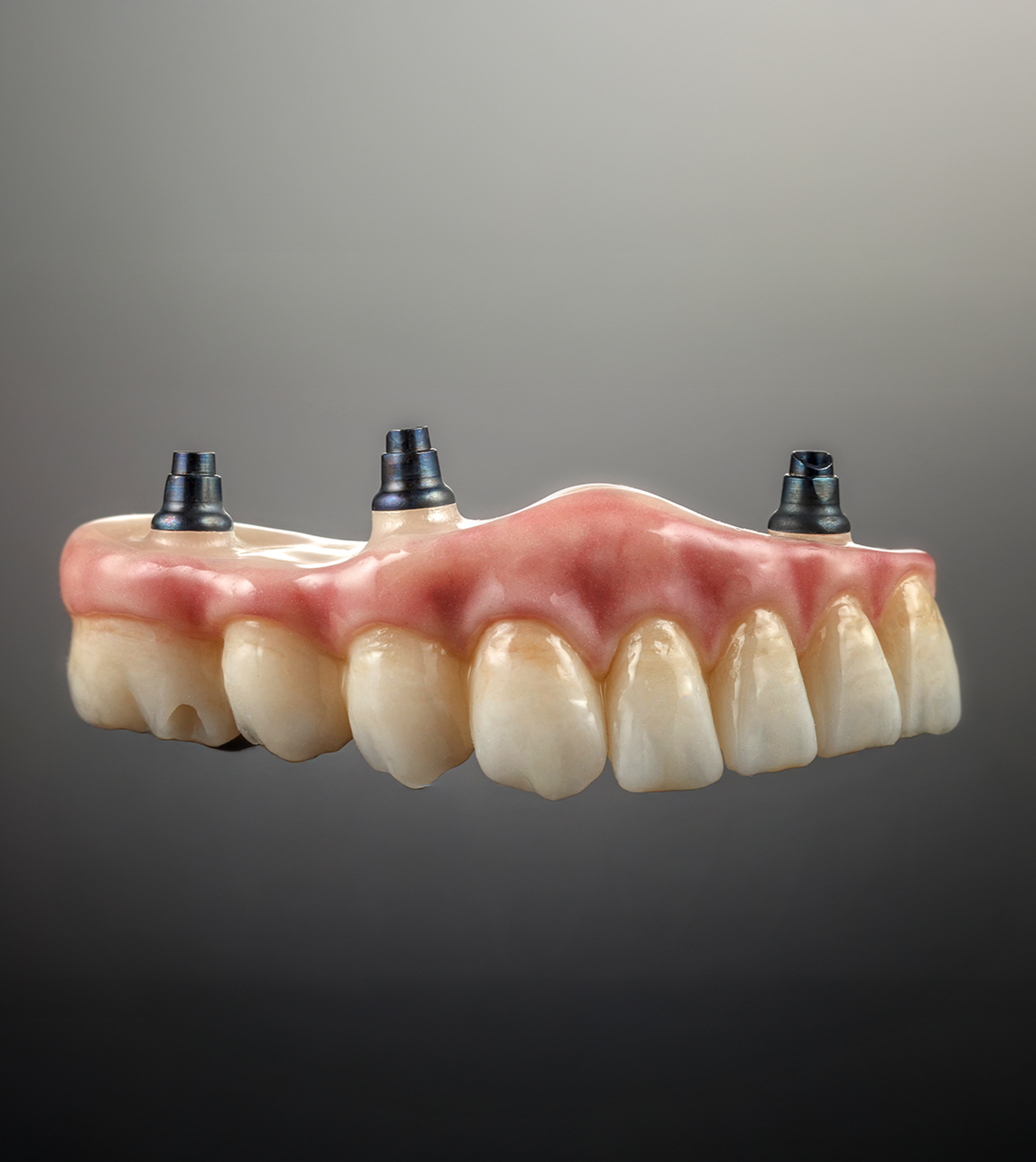 Upper dental prosthesis with pink gums and three metal implant abutments on a gray background