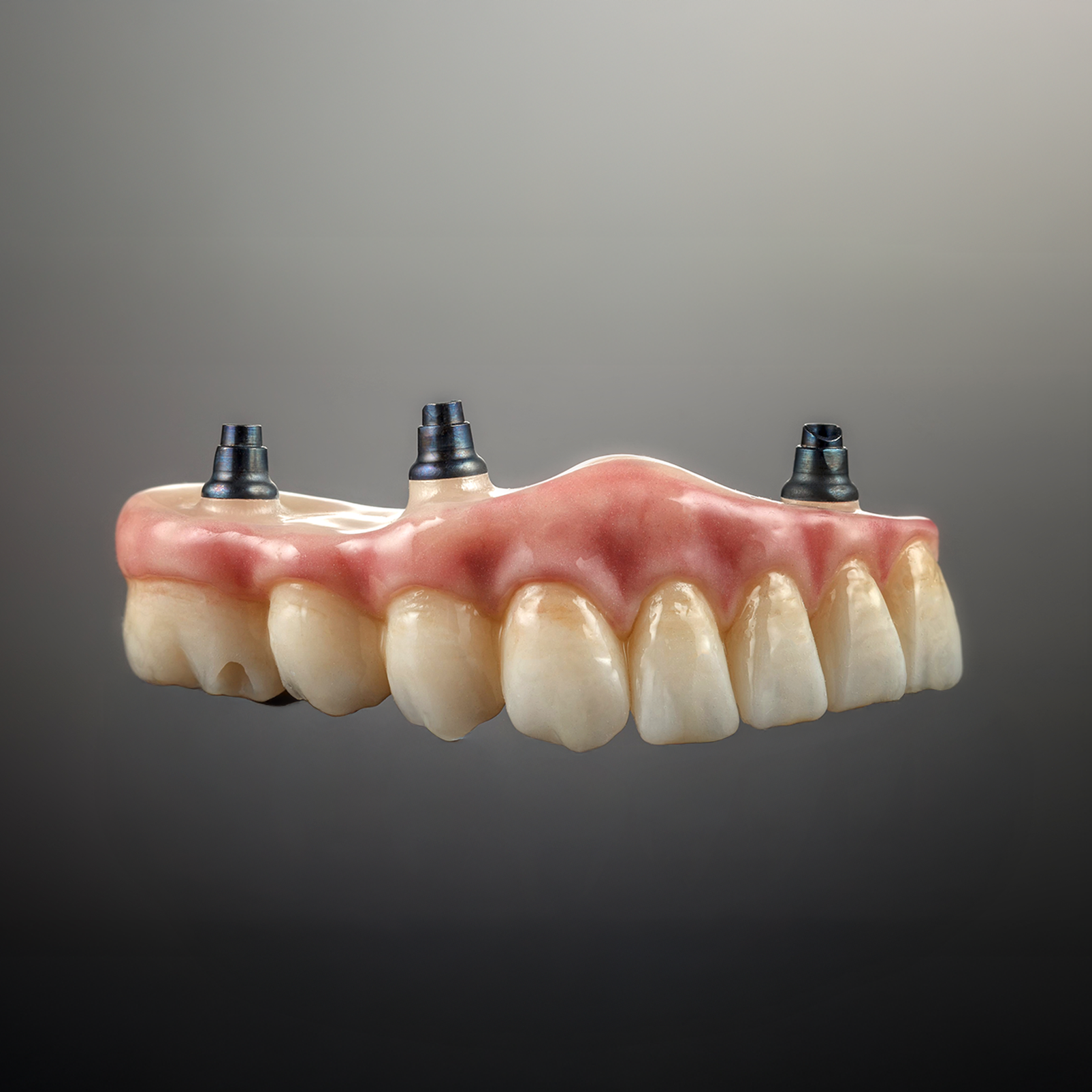 Dental implant bridge with three metal posts and pink gums on a gray background