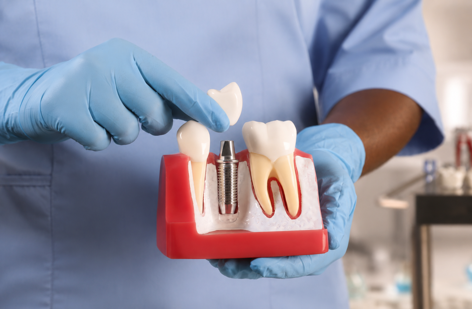 Gloved hands demonstrating dental implants on a model jaw