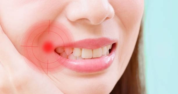 Close-up of a smiling mouth with a red glow highlighting cheek pain