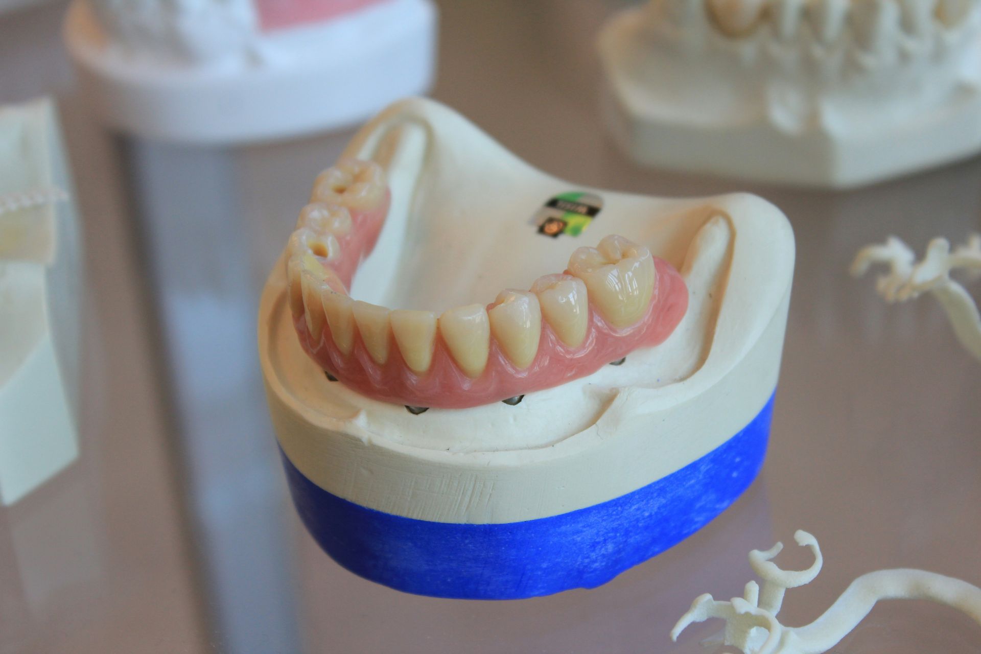 Dental model with pink teeth on a white base, wrapped with a blue band.