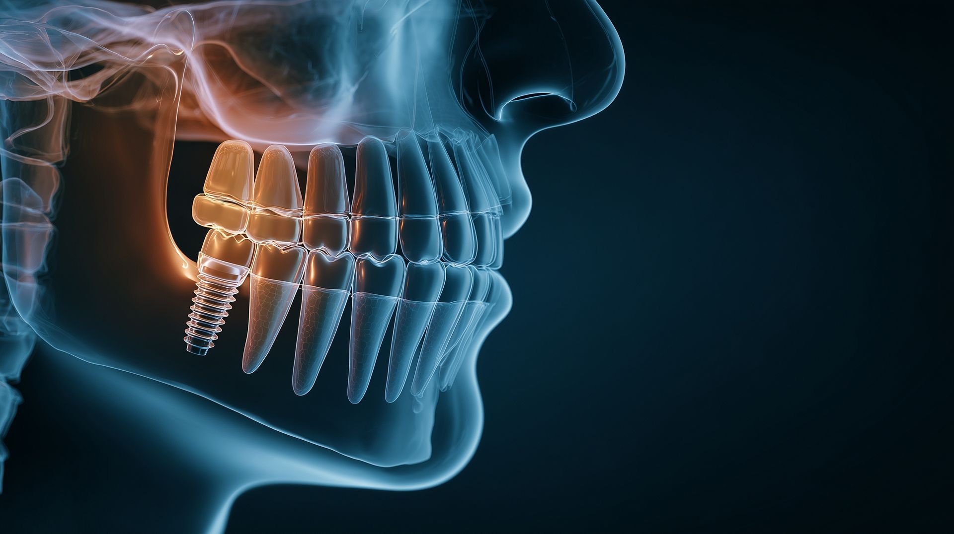 Side-view X-ray-style image of a jaw and teeth with glowing orange highlights on a dark blue background