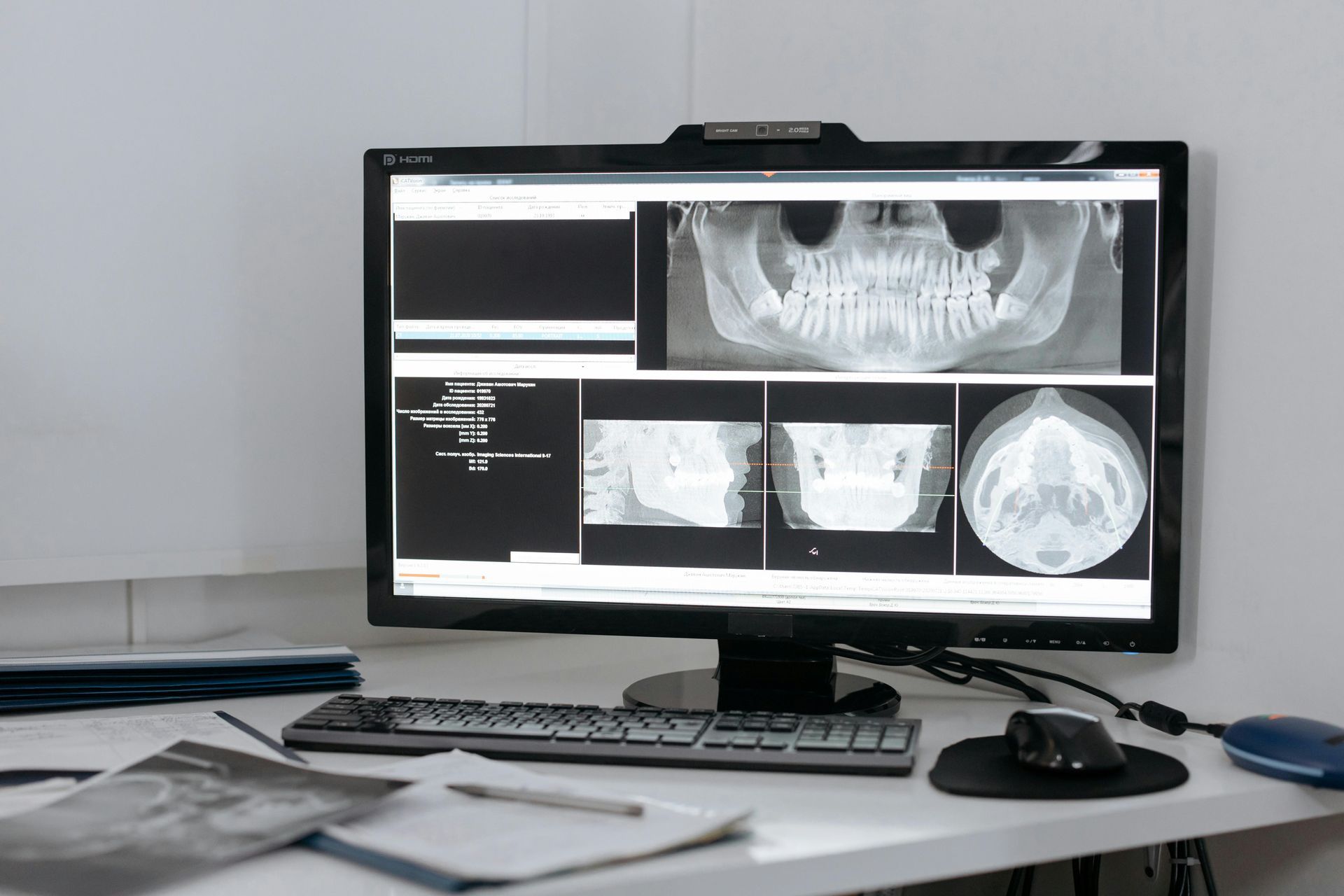 Desk with a widescreen monitor displaying medical scan images and a keyboard and mouse in front.