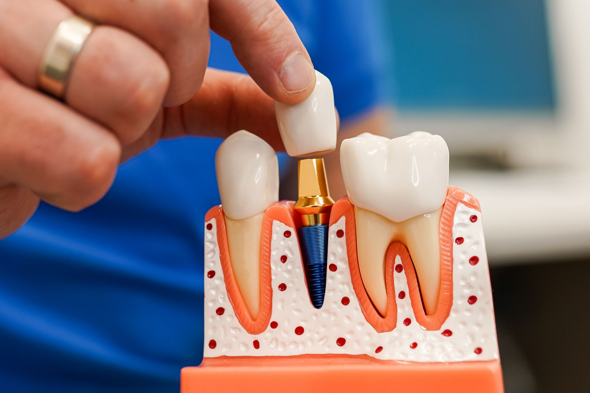 A middle aged male patient sitting in a chair listening to the dentist