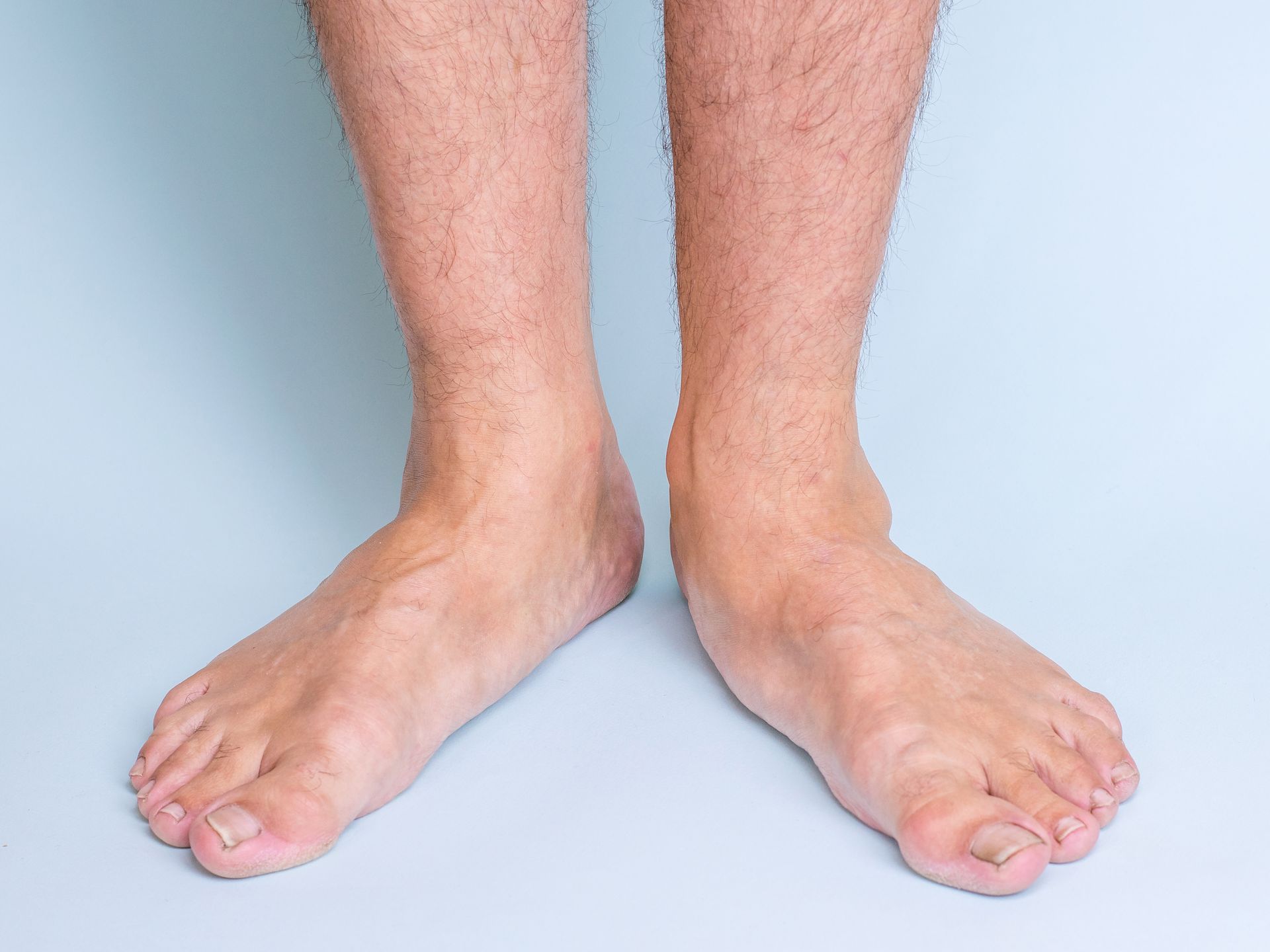 Bare feet, slightly splayed, on a light blue background.