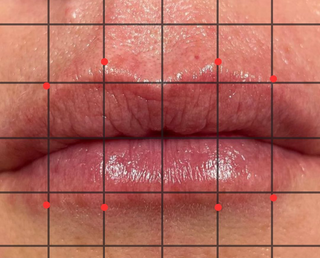 A close-up of human lips overlaid with a grid and red reference points indicating areas for facial assessment.