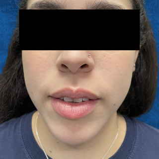 A person’s face, from the nose down to the chin, with a neutral expression against a plain, dark blue background.