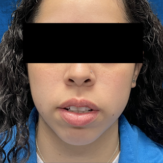 A person with long, curly dark hair, wearing a blue jacket, faces forward with their eyes obscured by a black bar.