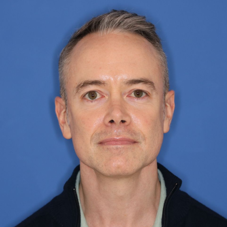 Man posing in front of a blue background after receiving CO2 treatment