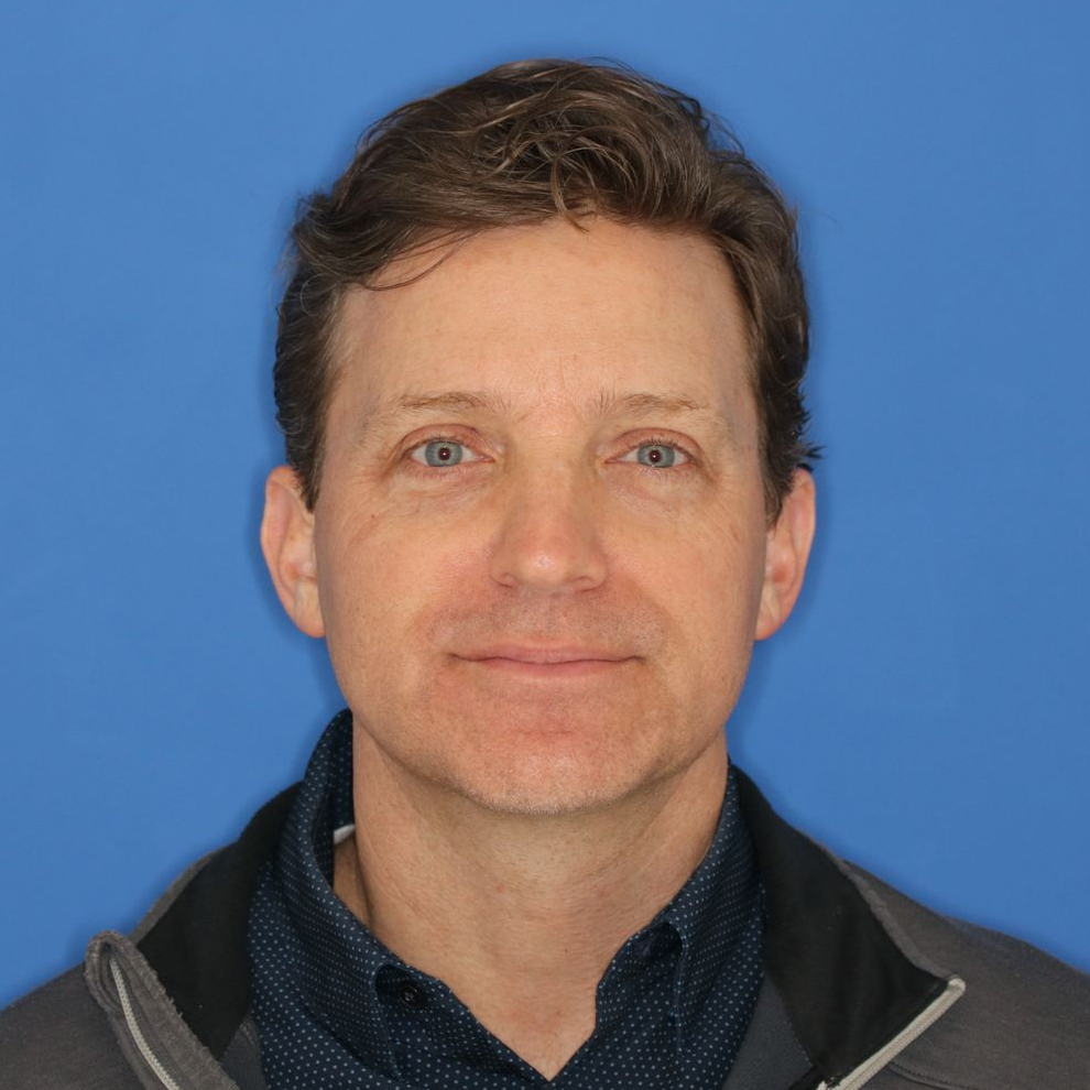 A man posing in front of a blue background for an after photo after CO2 laser treatment