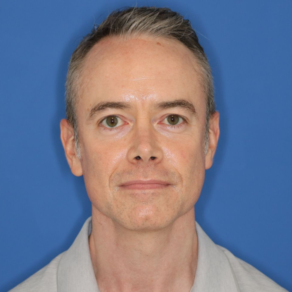 Man posing in front of a blue background before receiving CO2 treatment