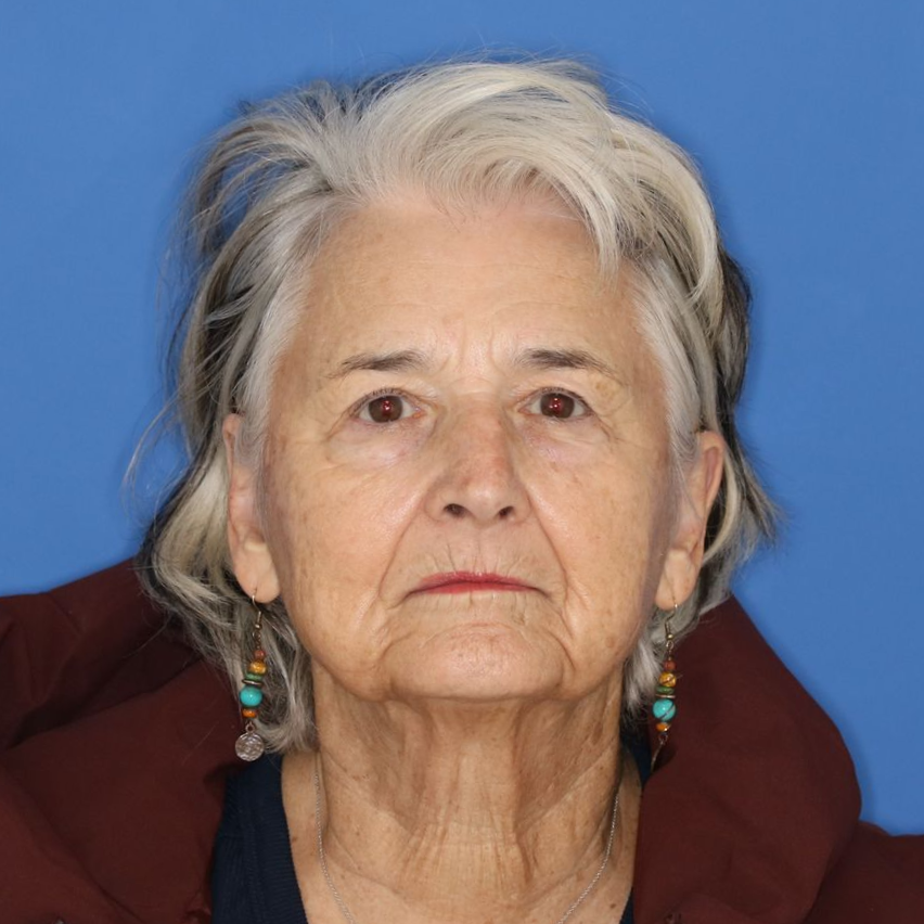Close up of a woman on a blue background posing for a before photo