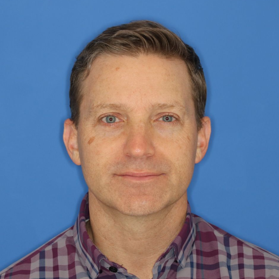 A man posing in front of a blue background for a before photo before CO2 laser treatment