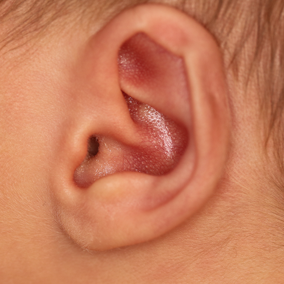Close up of an infant's ear before EarWell Infant Ear Molding at Carson Williams Facial Plastic Surgery in Leawood, KS