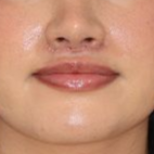 A close up of a woman 's lips and nose.