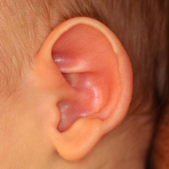 Close up of an infant's ear before EarWell Infant Ear Molding at Carson Williams Facial Plastic Surgery in Leawood, KS