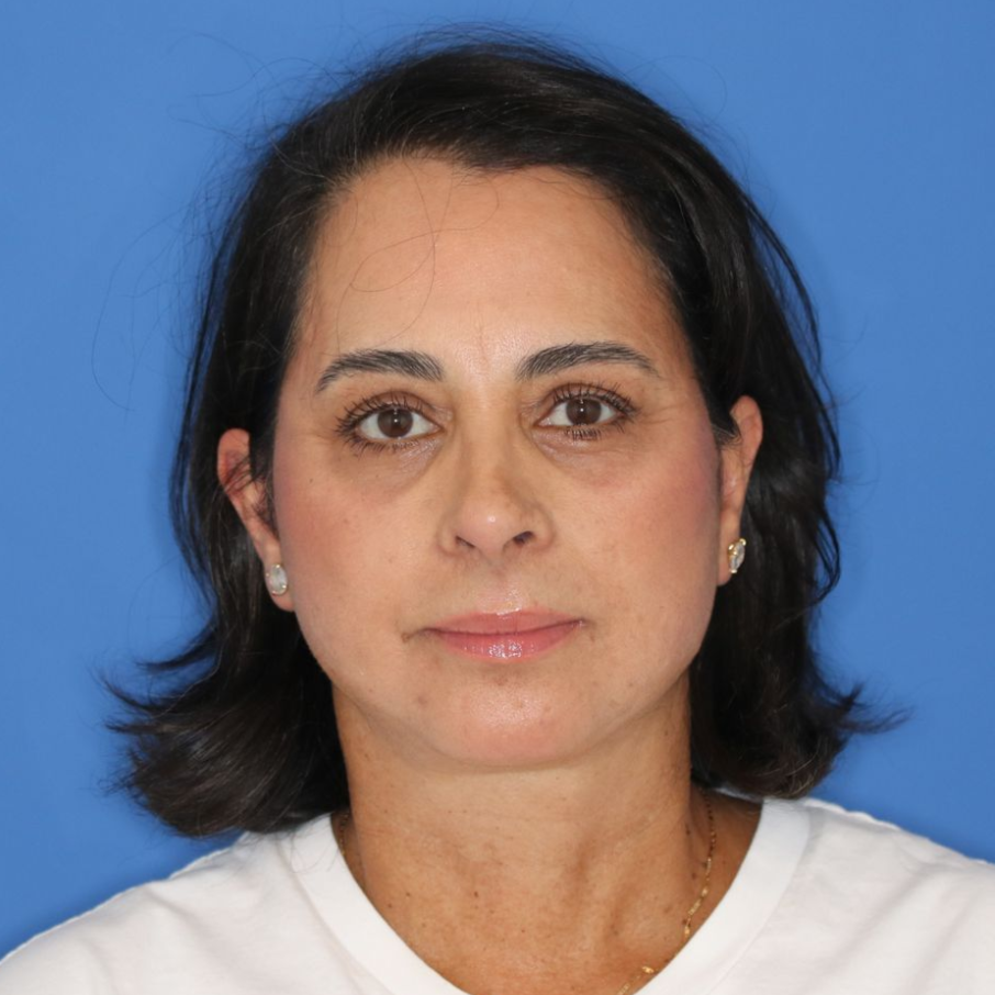 Woman posing for an after photo on a blue background